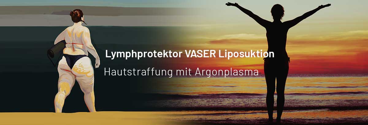 Lymphprotektor VASER Liposuktion | Hautstraffung mit Argonplasma