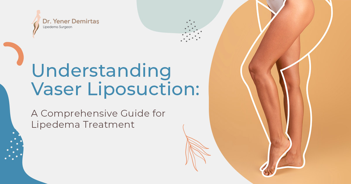 Understanding Vaser Liposuction: A Comprehensive Guide for Lipedema Treatment