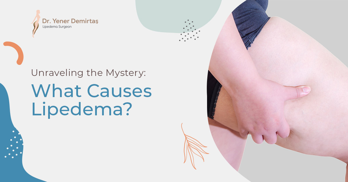 Unraveling the Mystery: What Causes Lipedema?