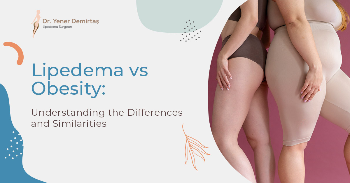 Lipedema vs Obesity: Understanding the Differences and Similarities