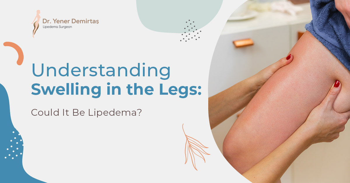 Understanding Swelling in the Legs: Could It Be Lipedema?